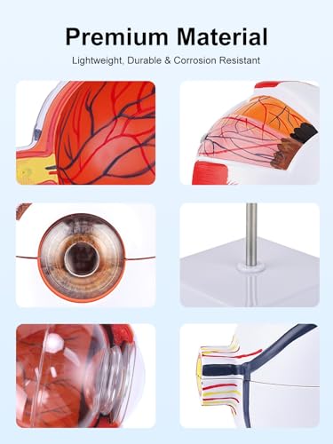 6X Enlarged Eyeball Model Detachable Eye Anatomy Model with Stand for Medical Science Education & Classroom Display