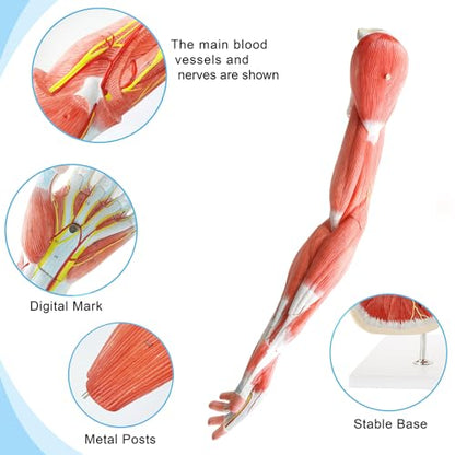 EVOTECH SCIENTIFIC Human Anatomical Muscular Arm Model, 7 Part Life Size