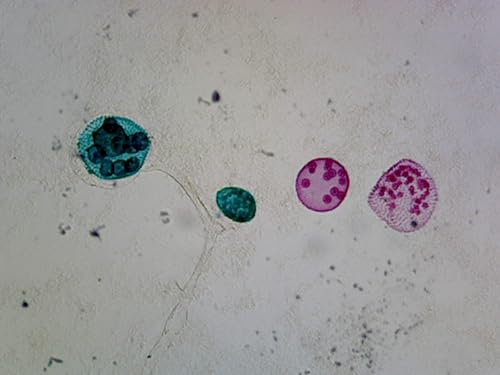 PS0107: Volvox Sexual Reproduction