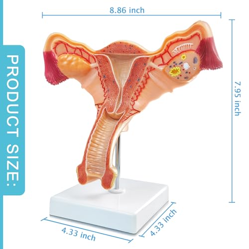 Human Uterus and Ovary Anatomical Model, Life-Size Realistic Female Anatomical Organs for Medical Science Education Study or Teaching