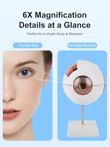 6X Enlarged Eyeball Model Detachable Eye Anatomy Model with Stand for Medical Science Education & Classroom Display