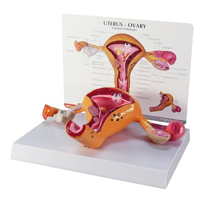 GPI Anatomicals Uterus and Ovary Model, Female Reproductive System - style: Uterus and ovary