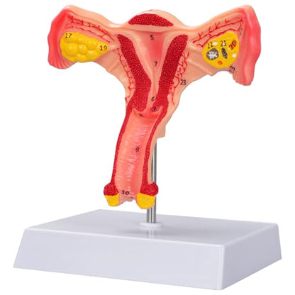 Human Uterus and Ovary Anatomical Model, Female Anatomy Organ for Education