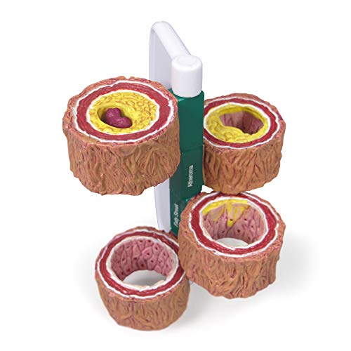 GPI Anatomicals 4-Piece Artery Model, Replica of an Artery with Plaque - style: Artery Model