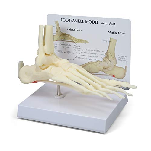 GPI Anatomicals Foot and Ankle Model, Replica with Plantar Fasciitis - style: Foot and Ankle with Plantar Fasciitis