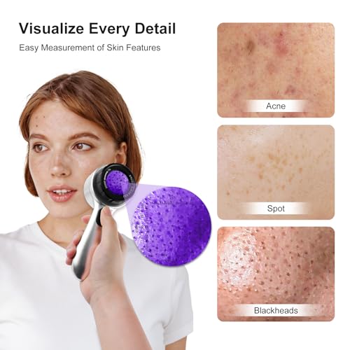 30x LED Dermatoscope Rechargeable Clarity 4 Modes Skin Scalp Hair