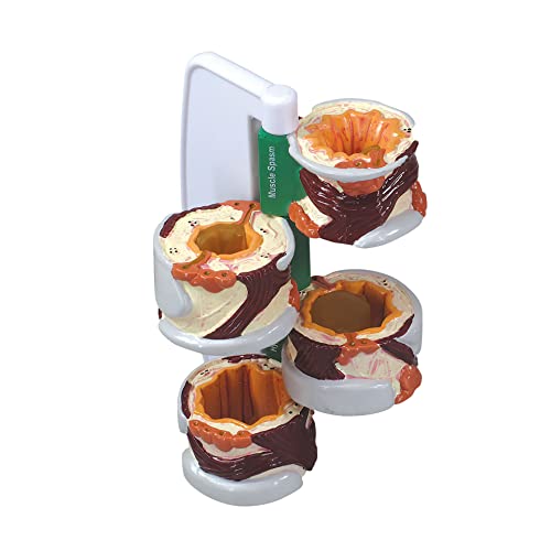 GPI Anatomicals 4-Piece Bronchus Model, Replica with Pathologies - style: Bronchus Model