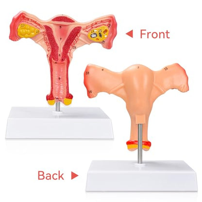 Human Uterus and Ovary Anatomical Model, Female Anatomy Organ for Education