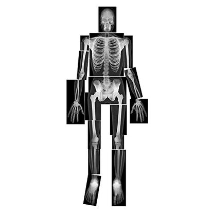 Roylco True to Life Human X-Rays