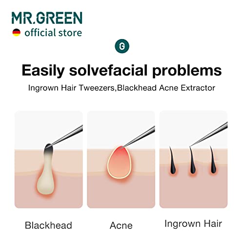 MR.GREEN Ingrown Hair Tweezers Needle Nose Pointed Tips Tweezers For Eyebrows Splinters Blackhead Removal Acne Clip Extractor (Short) - size: Short