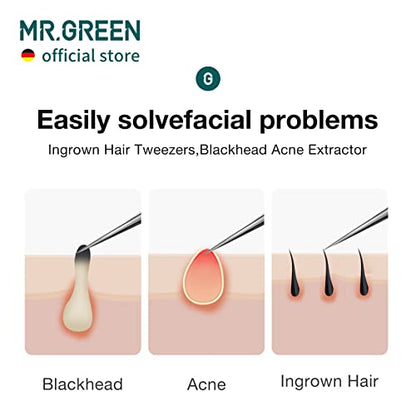 MR.GREEN Ingrown Hair Tweezers Needle Nose Pointed Tips Tweezers For Eyebrows Splinters Blackhead Removal Acne Clip Extractor (Short) - size: Short