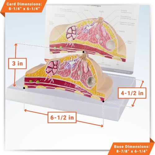 GPI Anatomicals Breast Cross-Section Model Showing Common Pathologies - style: Breast Cross-Section Model