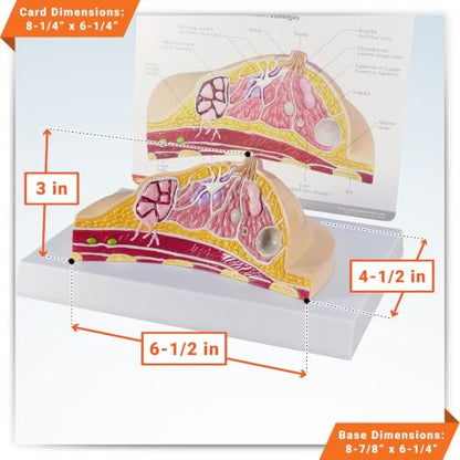 GPI Anatomicals Breast Cross-Section Model Showing Common Pathologies - style: Breast Cross-Section Model