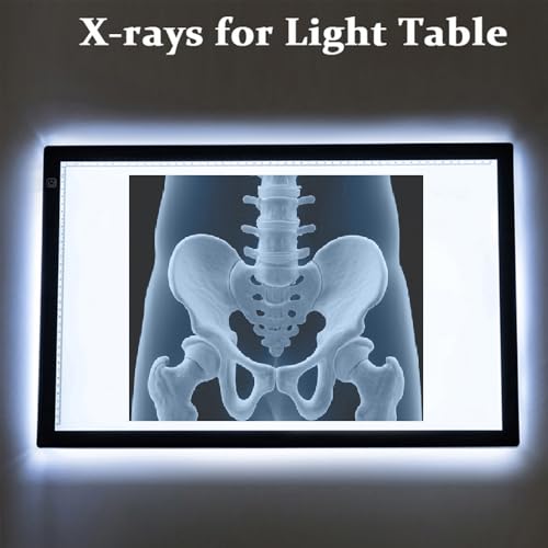 15 Pcs Human X-Ray Science Kit Tutorial Body Skeleton Xray Kit