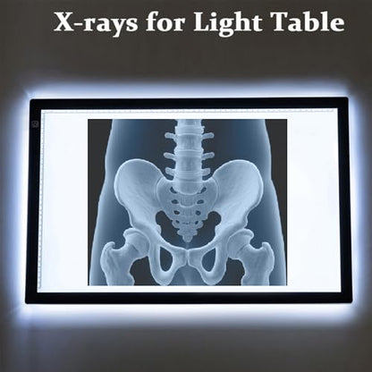 15 Pcs Human X-Ray Science Kit Tutorial Body Skeleton Xray Kit