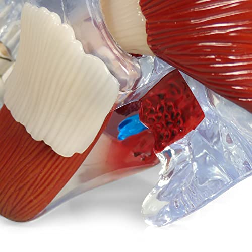 GPI Anatomicals Temporomandibular Joint (TMJ) Model with Pathologies
