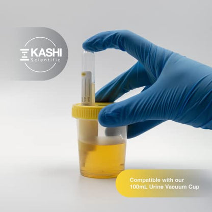 Kashi Scientific 10mL Urine Collection Vacuum Tube - Urinalysis Vacuum Tube with Yellow Cap, Pack of 100 Urine Tubes