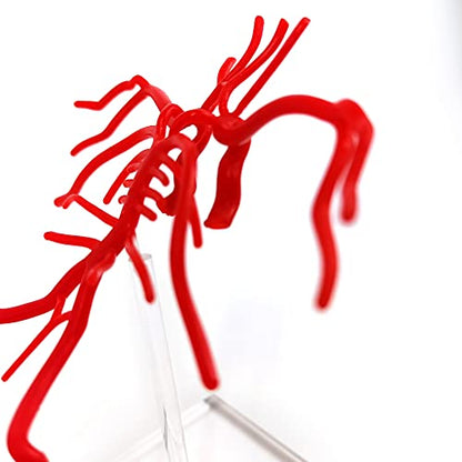Brain Artery Model, Life Size Intracranial Artery Model On Plexiglass Base