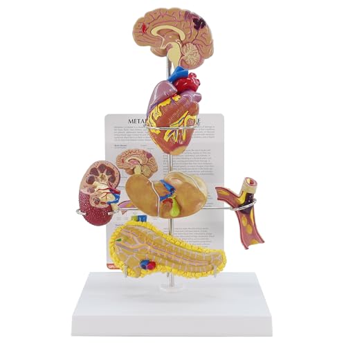 GPI Anatomicals Metabolic Syndrome Model Set - style: Metabolic Syndrome Model