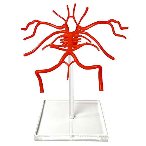Brain Artery Model, Life Size Intracranial Artery Model On Plexiglass Base