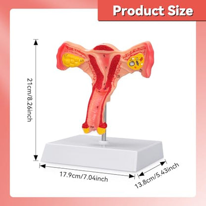 Human Uterus and Ovary Anatomical Model, Female Anatomy Organ for Education