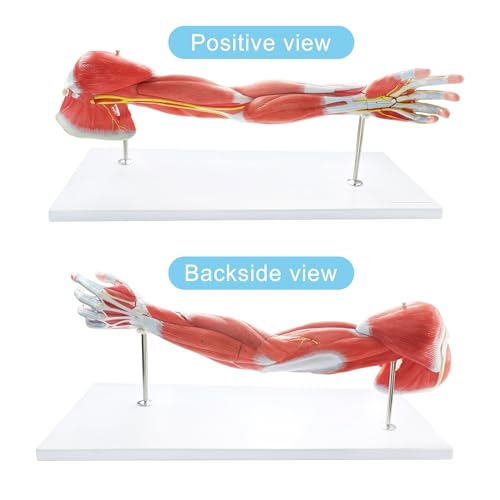 EVOTECH SCIENTIFIC Human Anatomical Muscular Arm Model, 7 Part Life Size