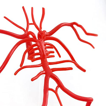 Brain Artery Model, Life Size Intracranial Artery Model On Plexiglass Base