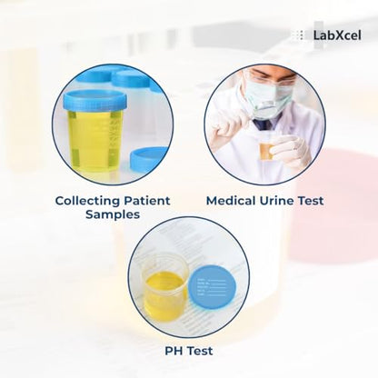 Polypropylene Clear Specimen Containers with Cap – Sample Collection Jar for Testing, Leak Resistant Screw Cap, 100ml-120ml, Non Sterile – 4.5oz Bulk Pack, 10 Count