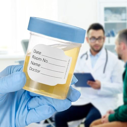 Vakly 4 oz Specimen Cups with Screw-On Lids Clear Non-Sterile 10 Pack