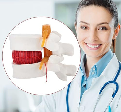 Human Lumbar Disc Herniation Model, 1.5 Times Durable and Lightweight Human Lumbar Disc Model, Visualized Anatomy of Lumbar Disc Herniation, Applied in Learning, Teaching, and Display