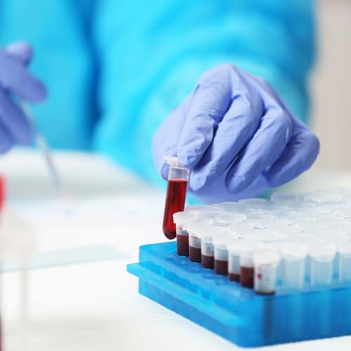 PATIKIL 100 Well Centrifuge Tube Freezer Storage Box, 2 Pcs Polypropylene Lockable Tube Rack for 1.5/1.8/2ML Tubes Vials Samples, Red - color: Red