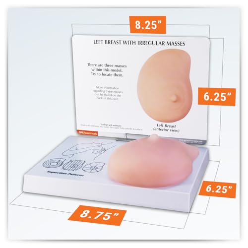 GPI Anatomicals Human Anatomy Model of Left Breast with Irregular Masses - style: Left Breast with Irregular Masses