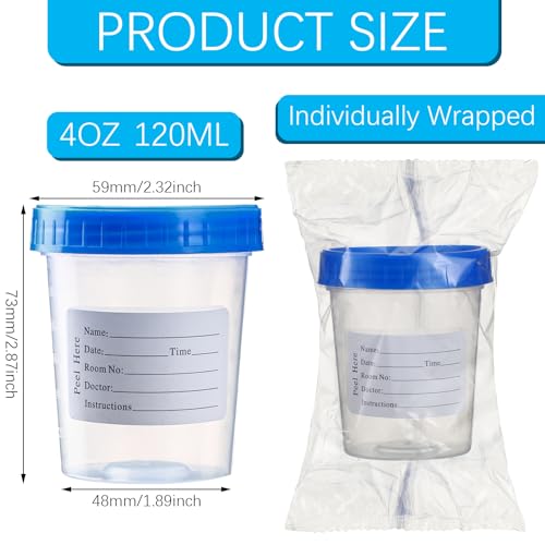 TrelaCo 50 Pcs 4oz Disposable Sterile Urine Specimen Cups with Lids