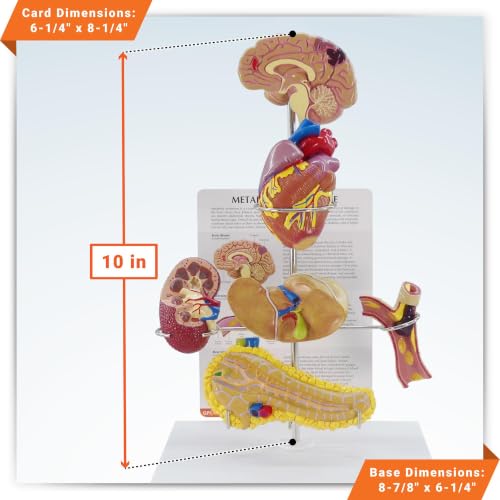 GPI Anatomicals Metabolic Syndrome Model Set - style: Metabolic Syndrome Model