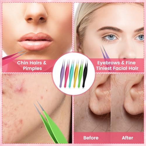 Nogeqi 6 Pcs Pointy Tweezers Pointed Tweezers Needle Nose Precision Fine Point Tweezer Pointed Tip Stainless Steel Ingrown Hair Tweezer For Nose Face Hair Eyebrow Blackhead Remover Women