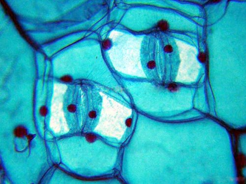 AmScope PS100A Prepared Microscope Slide Set, 100 Slides Set A - style: PS100A