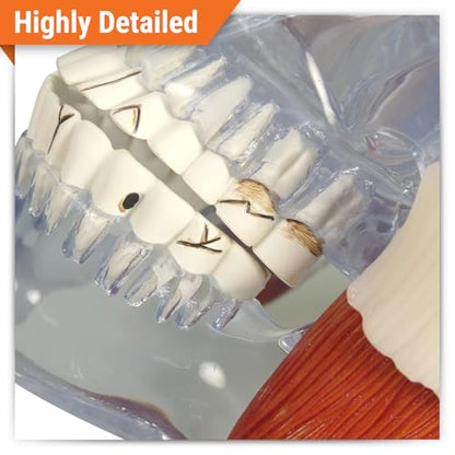 GPI Anatomicals Temporomandibular Joint (TMJ) Model with Pathologies