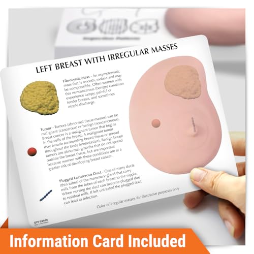 GPI Anatomicals Human Anatomy Model of Left Breast with Irregular Masses - style: Left Breast with Irregular Masses
