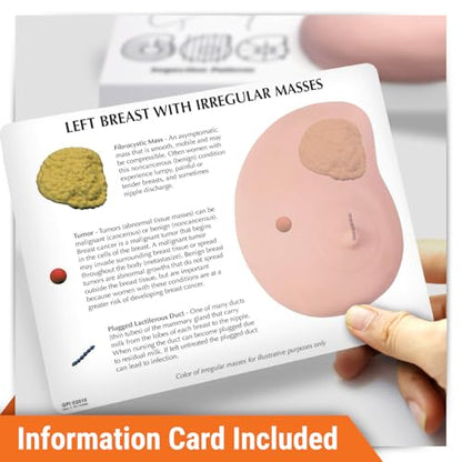GPI Anatomicals Human Anatomy Model of Left Breast with Irregular Masses - style: Left Breast with Irregular Masses