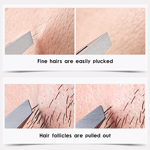 Stainless Steel Precision Eyebrow Tweezers Flat Tweezers for Eyebrows for Women-for Facial Hair and Ingrown Hair Removal Beauty Tools - color: 1 Pack (Flat)