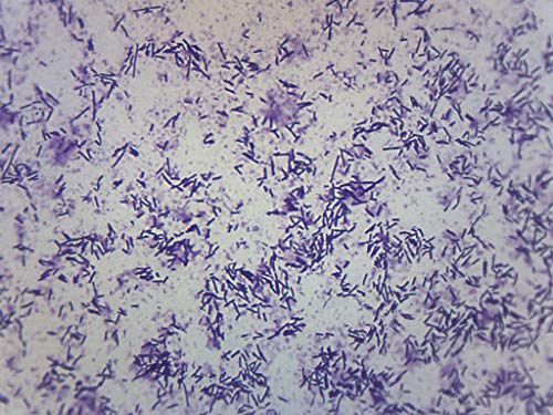 EISCO Escherichia Coli Smear, Gram Stain - Prepared Microscope Slide - 75 x 25mm - Biology & Microscopy