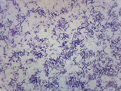 EISCO Escherichia Coli Smear, Gram Stain - Prepared Microscope Slide - 75 x 25mm - Biology & Microscopy