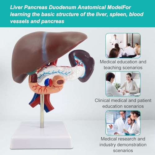 qzzXoq Liver Pancreas Duodenum Model, Human Liver Anatomical Model 3 Parts Life-Size Detachable Liver Spleen Blood Vessels Pancreas Suitable for Medical Teaching Scientific Education - color: Hepatopancreas