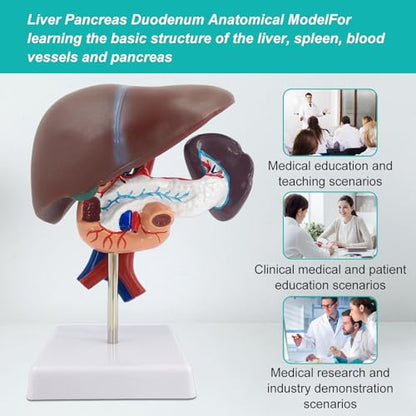 qzzXoq Liver Pancreas Duodenum Model, Human Liver Anatomical Model 3 Parts Life-Size Detachable Liver Spleen Blood Vessels Pancreas Suitable for Medical Teaching Scientific Education - color: Hepatopancreas