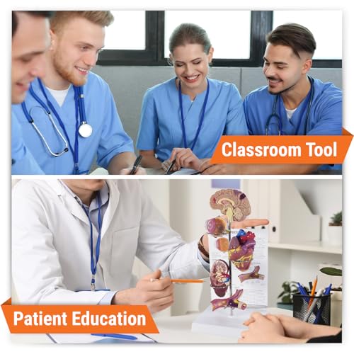 GPI Anatomicals Hypertension Model Set - style: Hypertension Model