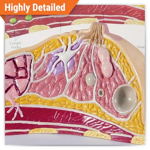 GPI Anatomicals Breast Cross-Section Model Showing Common Pathologies - style: Breast Cross-Section Model
