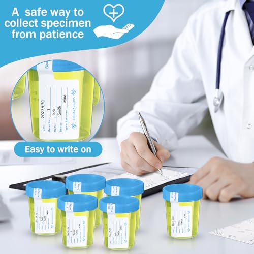 25 Pcs Urine Specimen Cups with Lids Urine Sample Cups, Blue Lids - color: Blue Lids