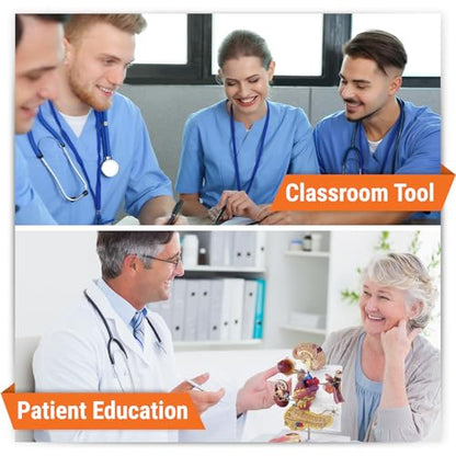 GPI Anatomicals Type II Diabetes Model Set - style: Type II Diabetes Model