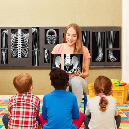 Lineshading 16 Pieces Human x Rays Bones Pretend x Rays for Kids Human Bones Body Educational Science Kit Display Play Table(Black and White) - color: Black and White