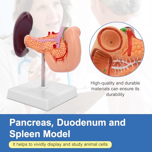 Spleen Pancreas Duodenum Model, Human Spleen Anatomical Model Pancreas Duodenum Spleen Celiac Trunk with Number Manual, for Medical Teaching Scientific Education - color: Spleen and Pancreas
